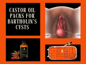Castor Oil Packs for Bartholin Cysts: Facts and Myths