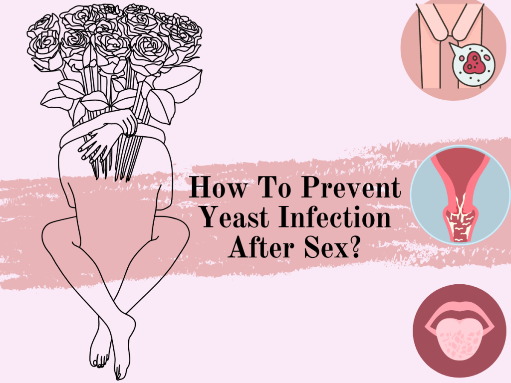 How To Prevent Yeast Infection After Sex Sexual Wellness 101