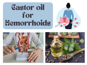 How to Use Castor Oil for Hemorrhoids?