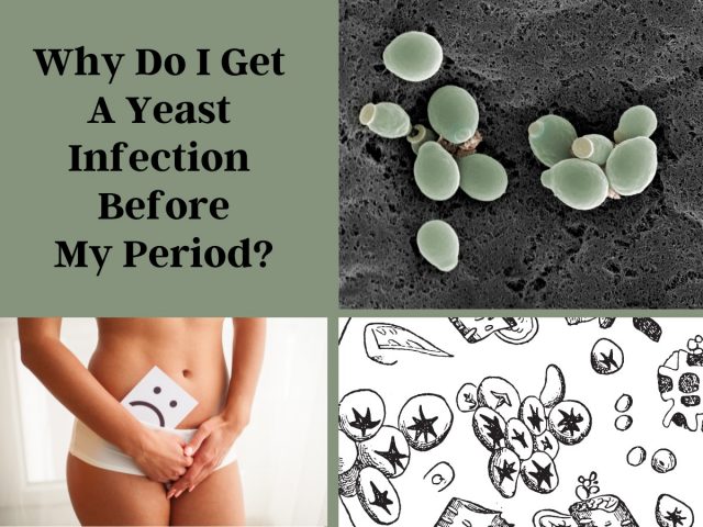 Why Do I Get A Yeast Infection Before My Period Causes