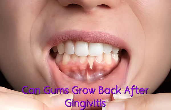 Can Gums Grow Back After Gingivitis