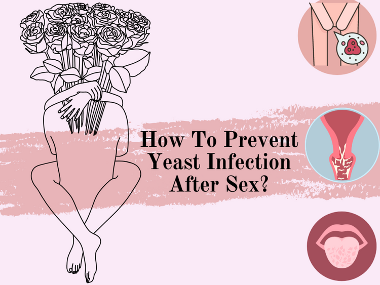 How To Prevent Yeast Infection After Sex? Sexual Wellness 101 – The