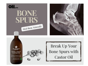 How to Dissolve Bone Spurs with Castor Oil?