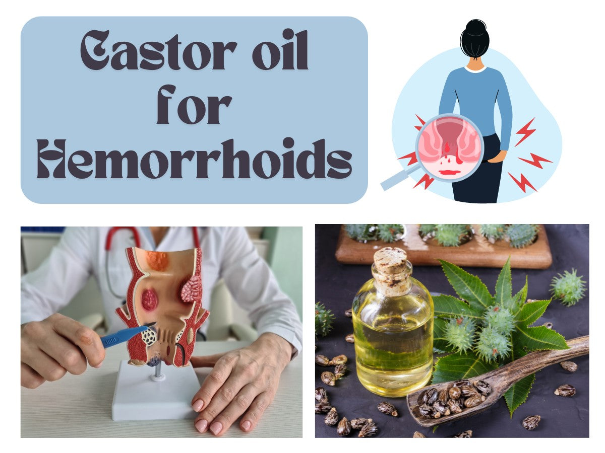 How to Use Castor Oil for Hemorrhoids?