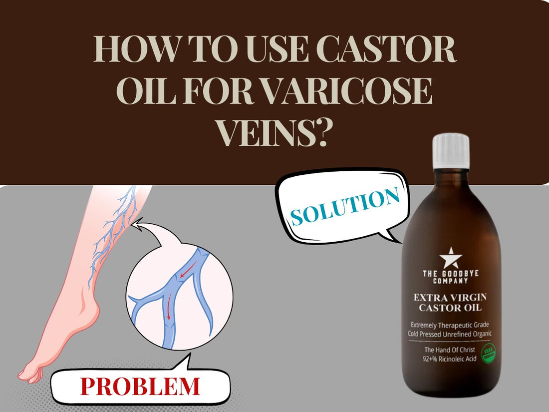 How to Use  Castor Oil for Varicose Veins?