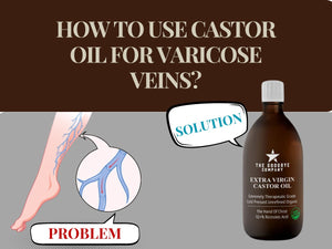 How to Use  Castor Oil for Varicose Veins?