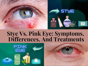 Stye Vs. Pink Eye – Symptoms, Differences, And Treatments