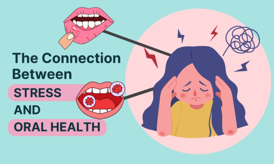 Can Stress Affect Your Teeth and Gums? Here’s the Alarming Truth!