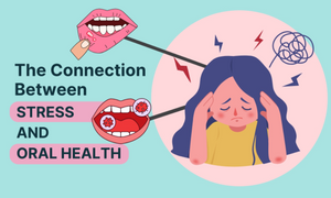 Can Stress Affect Your Teeth and Gums? Here’s the Alarming Truth!