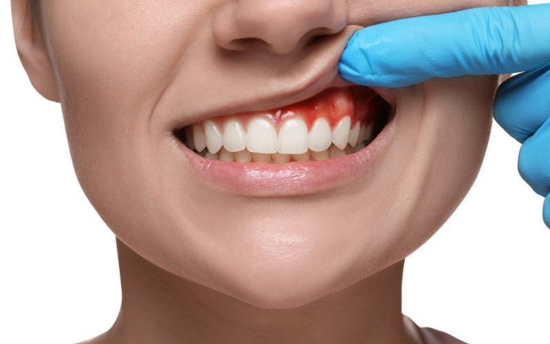 Why is my gum white and painful?