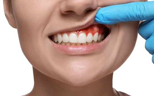 Why is my gum white and painful?