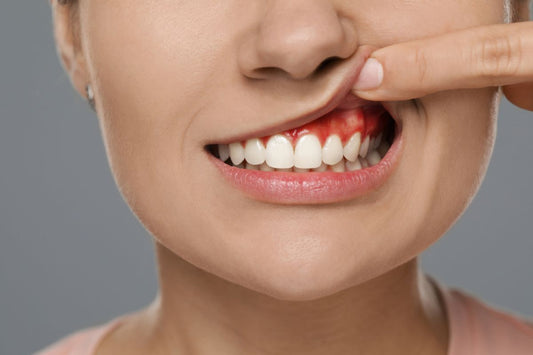 How to remove gum abscess.