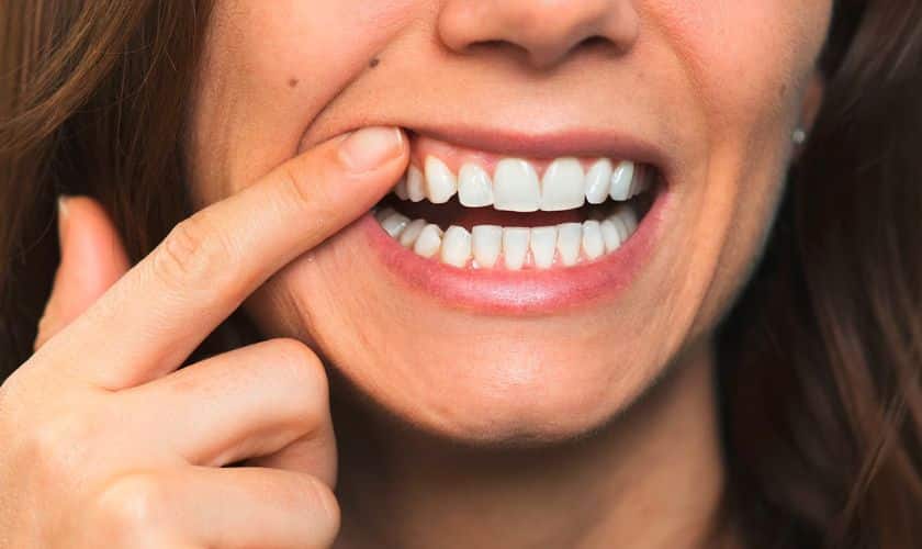 Why Do I Have a Hole in My Gum?Know the Reasons and the Treatment