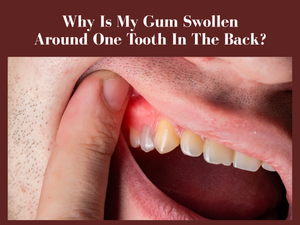 Why Is My Gum Swollen Around One Tooth In The Back