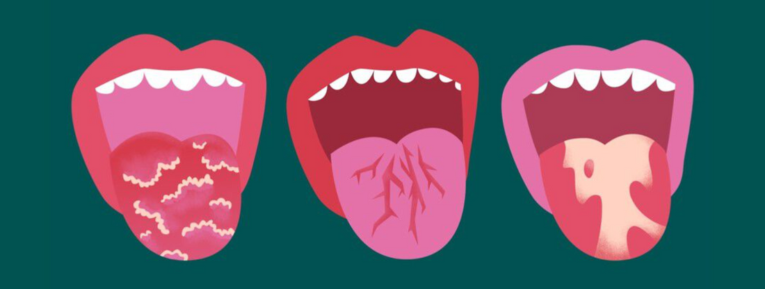 Can psoriasis affect your gums?