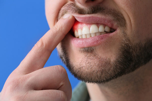 Why Are My Upper Gums Throbbing: What's Really Going On in Your Mouth?