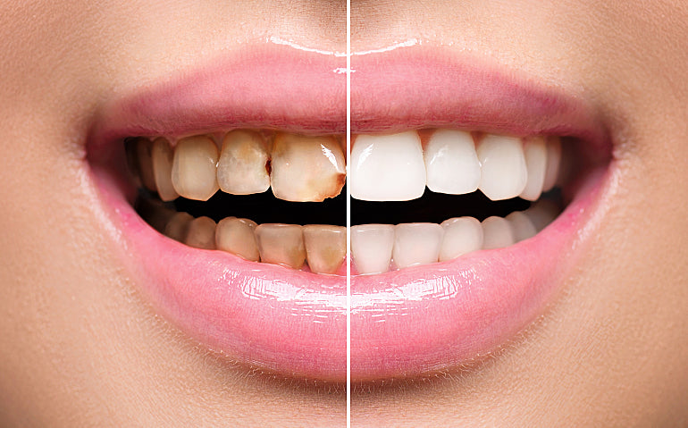 When is it too late to reverse gum disease?