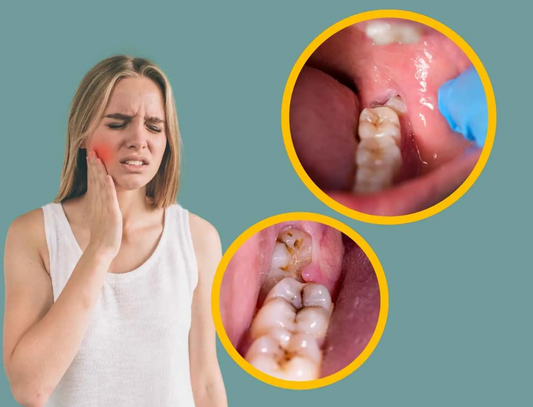 Why do my gums hurt in the back?