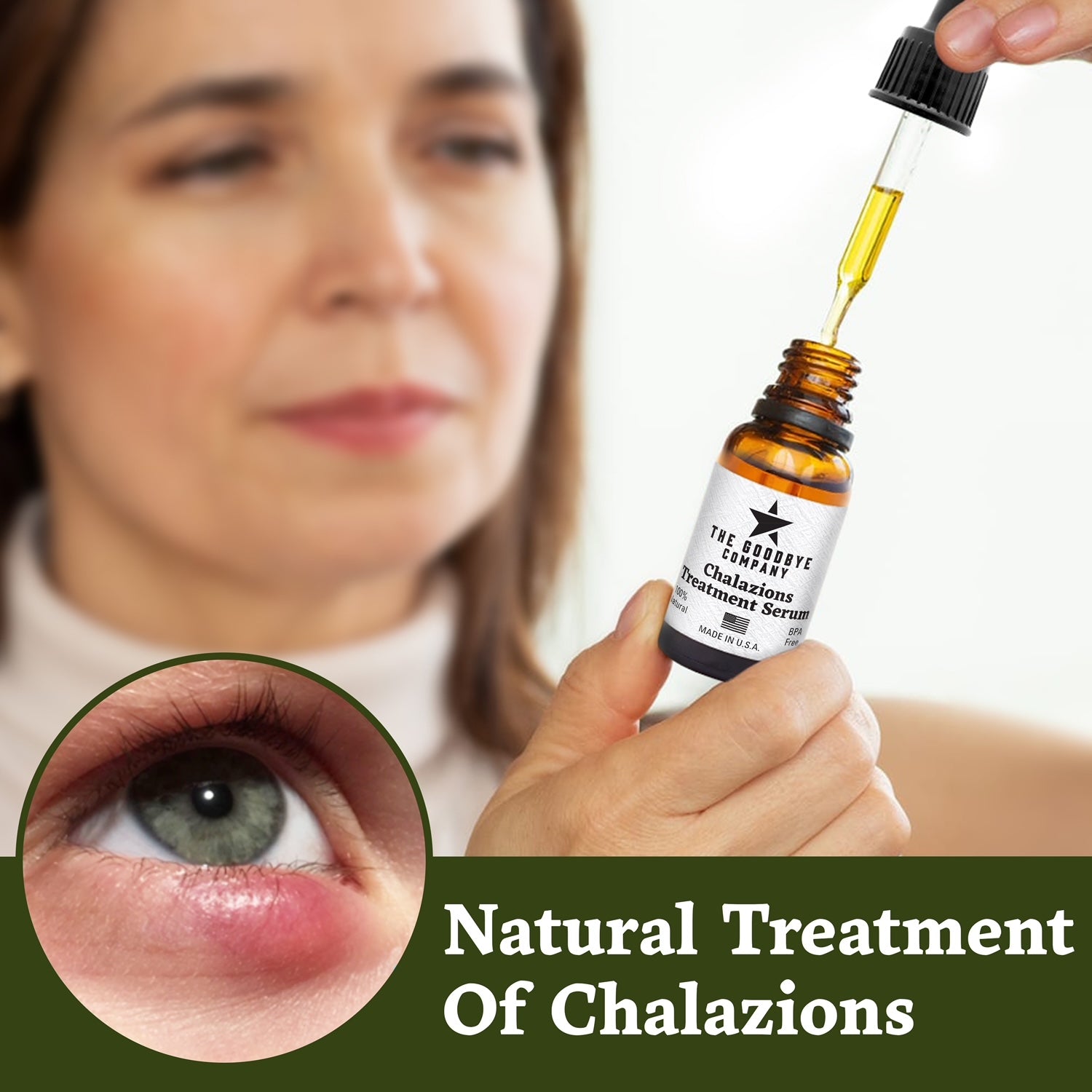 The Goodbye Company Chalazion Remover