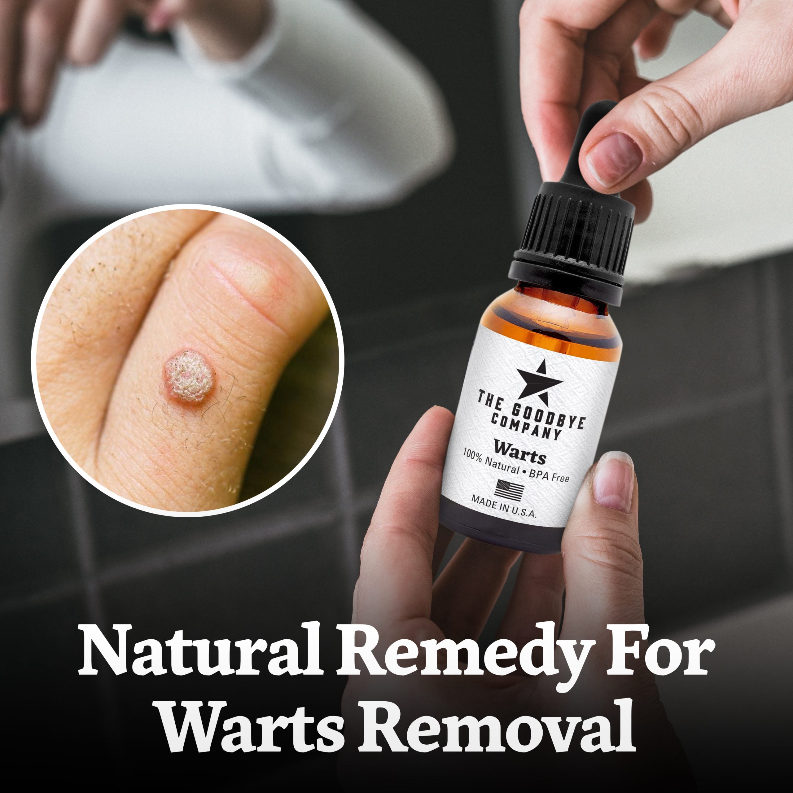 The Goodbye Company Effective Wart Remover