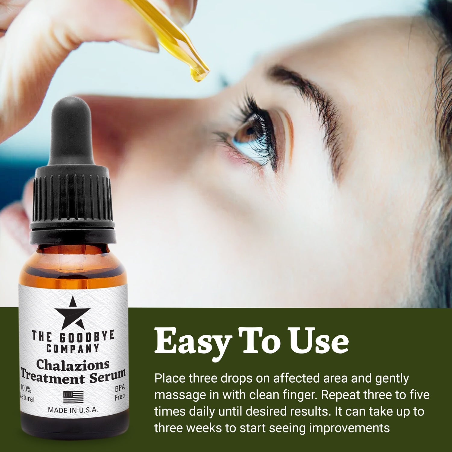 The Goodbye Company Chalazion Remover