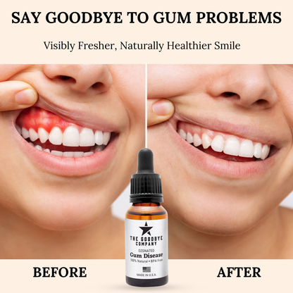 The Goodbye Company Ozonated Gum Disease