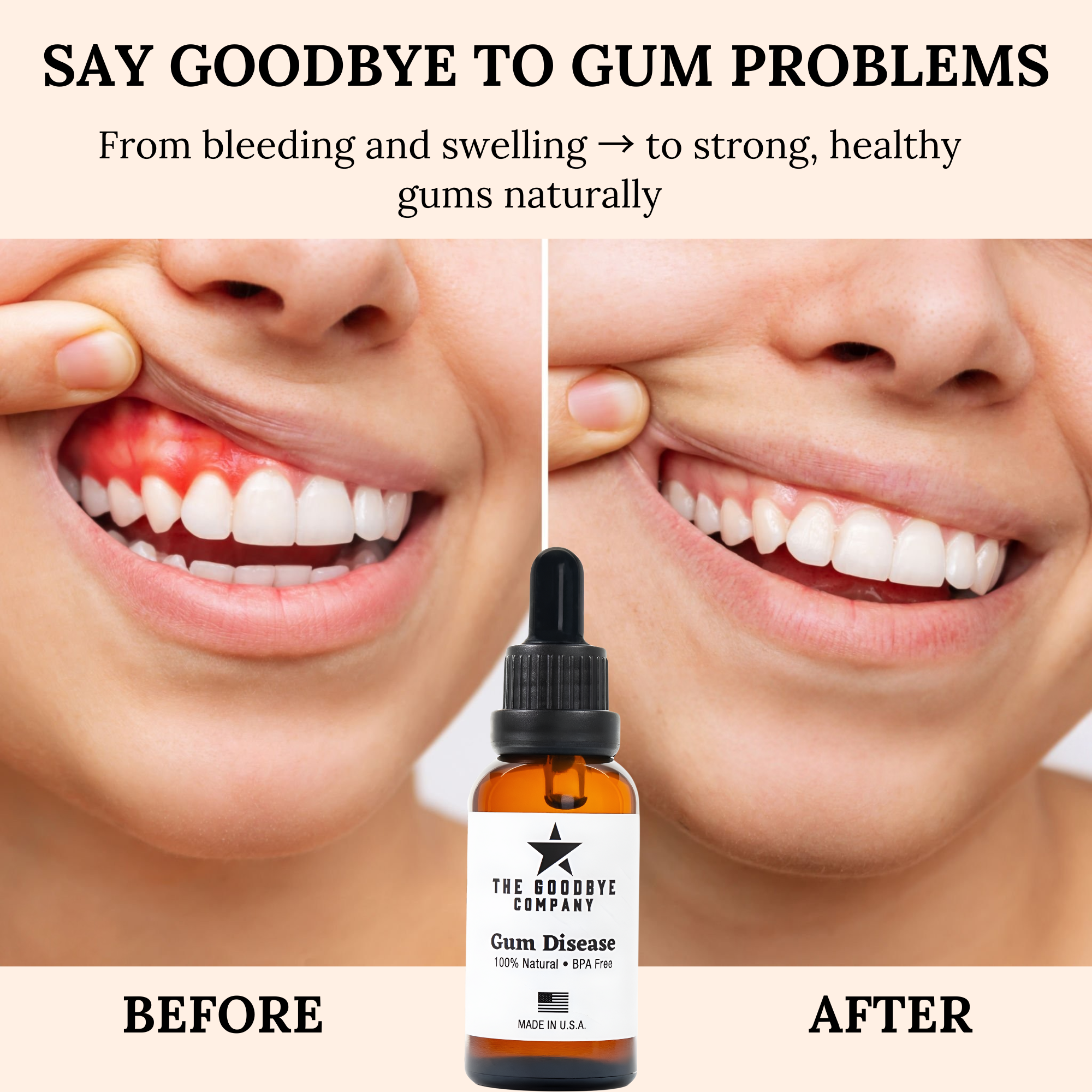 Heal your gums and mouth naturally