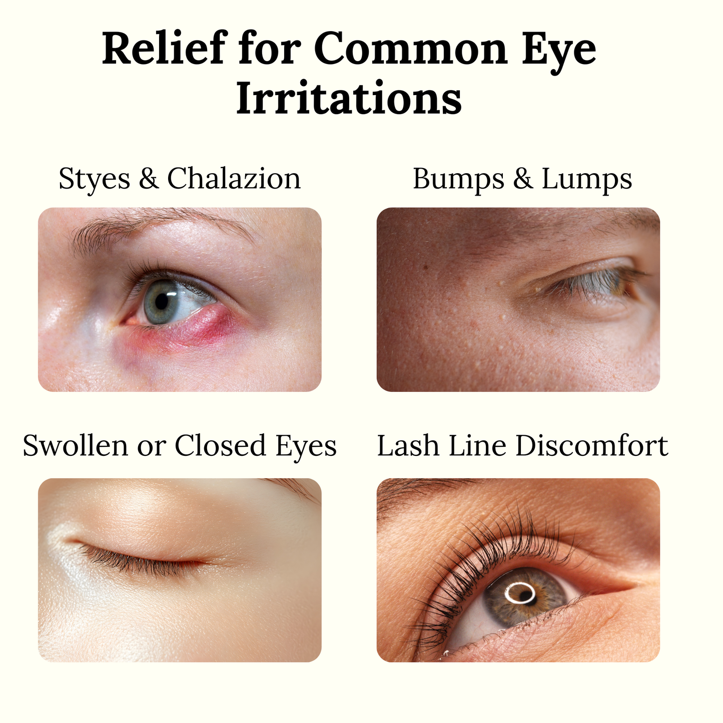 The Goodbye Company Stye Eye Care Oil