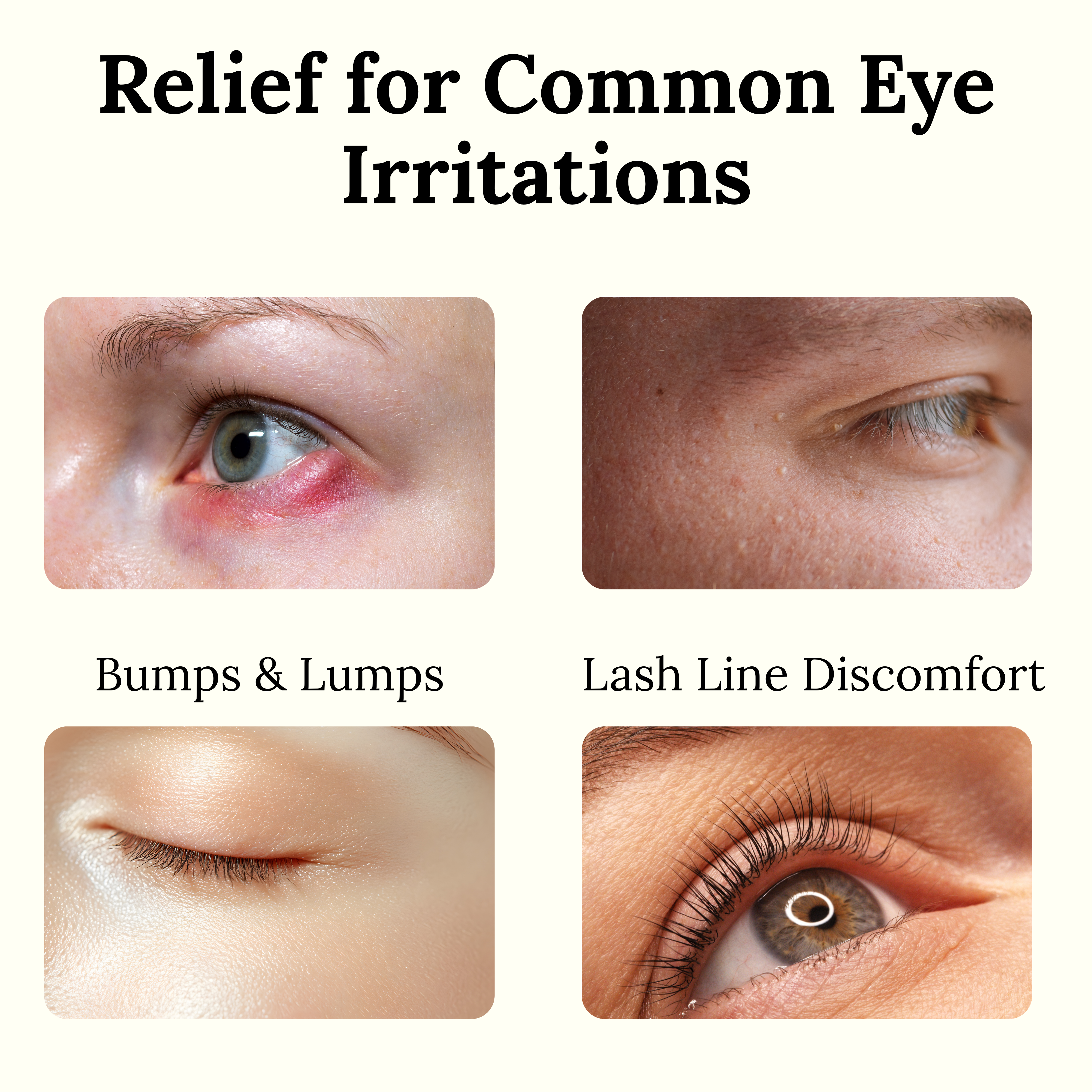 The Goodbye Company Stye Eye Care Oil